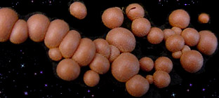  Lycogala epidendrum 